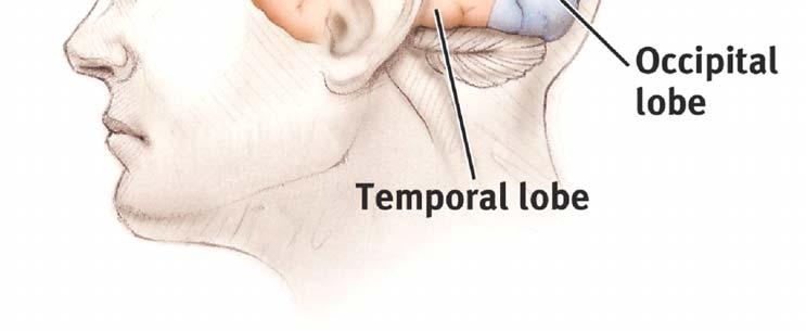 These lobes are the frontal lobe (forehead), parietal lobe (top