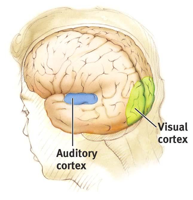Auditory Function The functional MRI scan shows the
