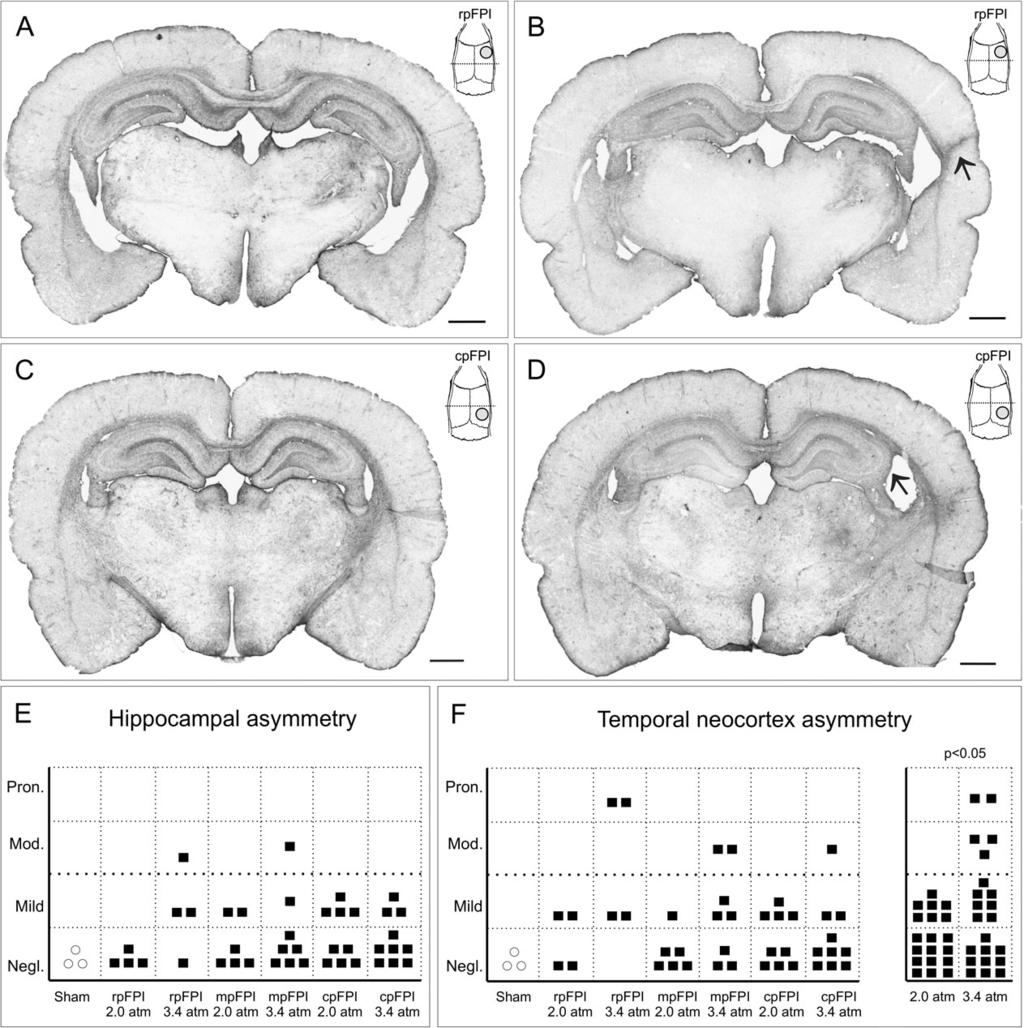 Figure 7. Hippocampal and temporal neocortex atrophy in posttraumatic epileptic rats after frontal, parietal, and occipital FPI.