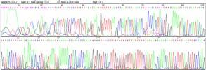 Gene Expression Profiling of Hematopoietic Stem Cells ligonucleotide Microarray RT IVT Biotin Biotin Hybridize Biotin Biotin Biotin Scan CD34+ Total RNA cdna crna Microarray Expression Image Risk