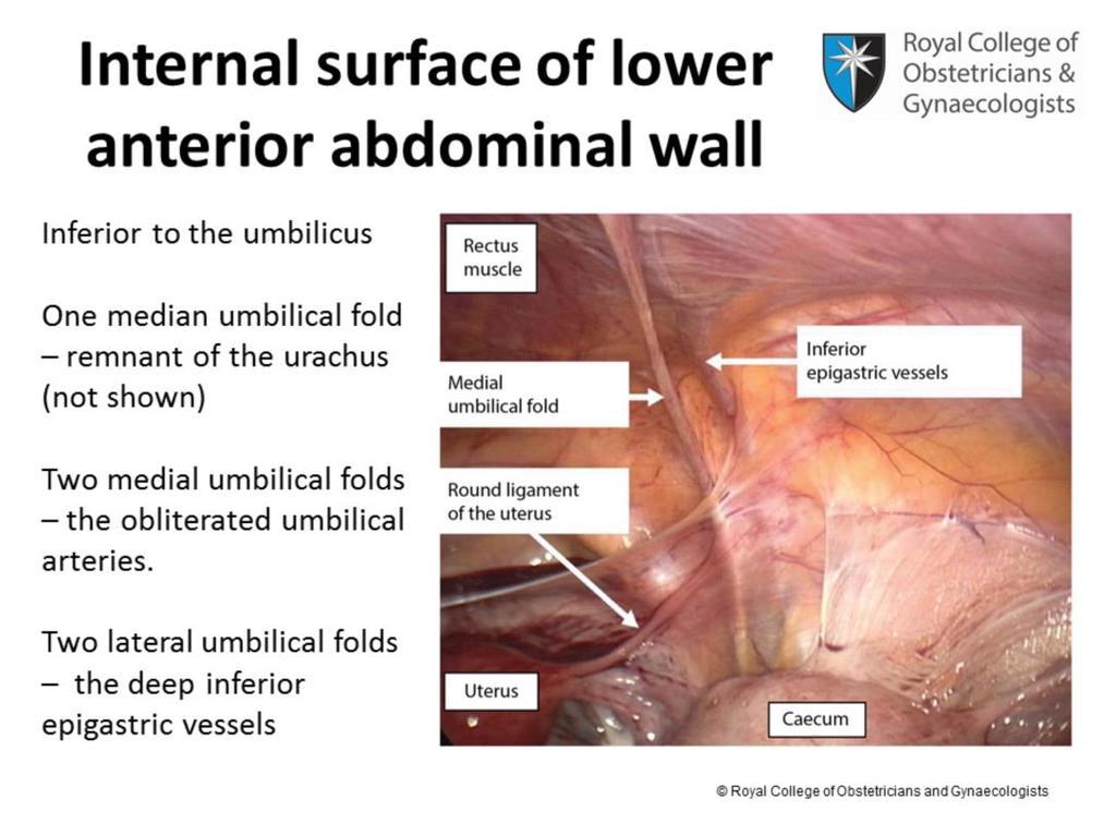 Inferior to the umbilicus there are five vertical peritoneal folds that converge at the umbilicus.