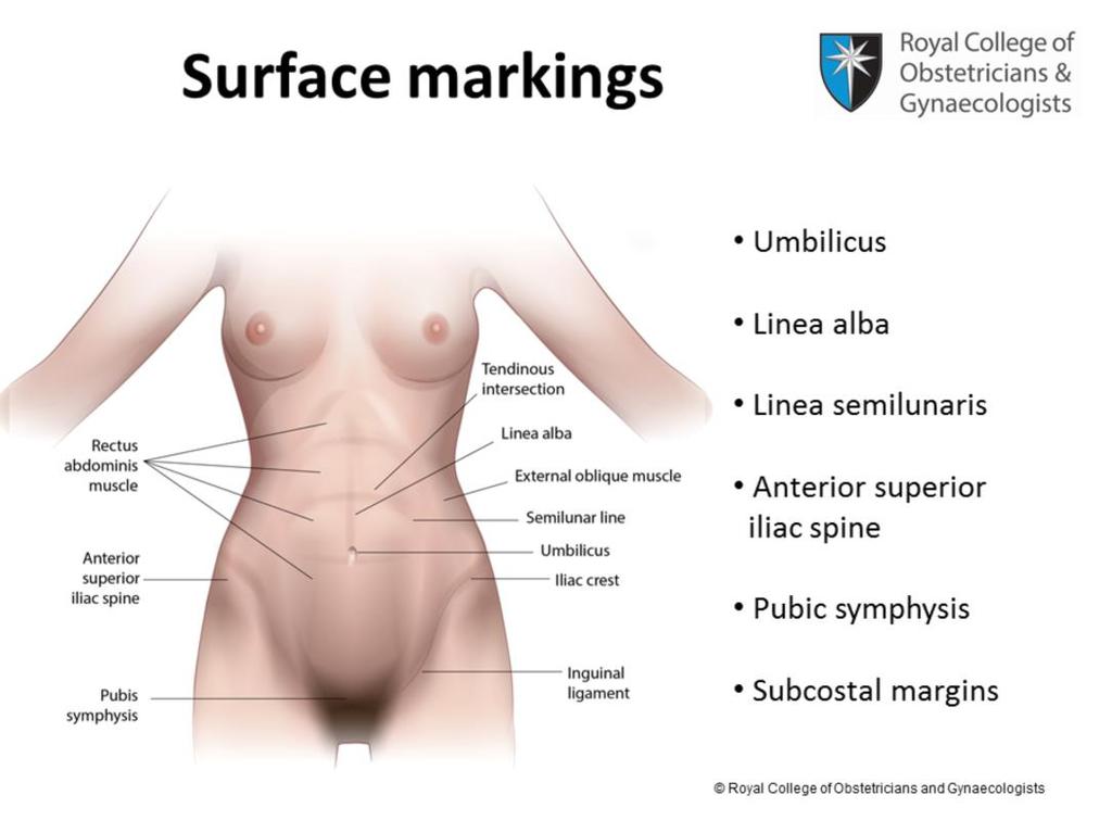 In addition to the structures that define the upper and lower borders of the anterior abdominal wall, important surface markings need to be noted.
