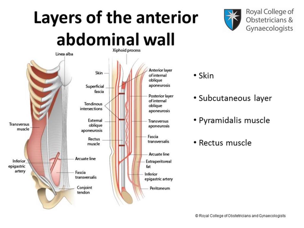 A cross section of the anterior abdominal wall will reveal, from outwards inwards: the skin, the subcutaneous layer, which is made up of fatty tissue called the Camper's fascia and membranous tissue