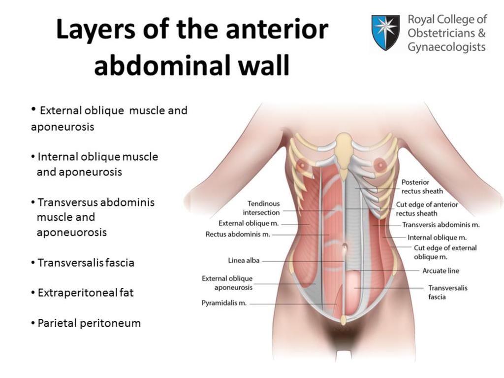 Beneath the rectus muscle is the external oblique muscle and its aponeurosis, the internal oblique muscle and its aponeurosis, the transversus abdominis muscle and its aponeurosis, the transversalis