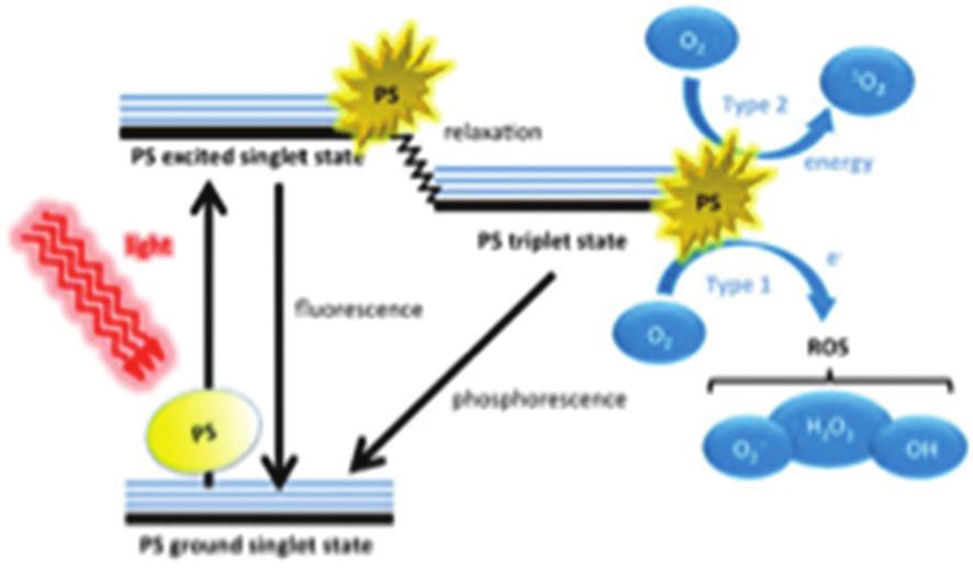 Figure 1: Mechanism of photodynamic therapy such as lipopolysaccharide and proteases, may act as an additional benefit.