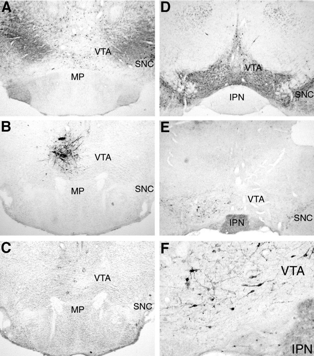 J. Neurosci., 2000, Vol. 20 3of5 Figure 1. Histological examination of the VTA. A, Expression of TH in the rostral VTA ( 4.8 mm posterior to bregma).