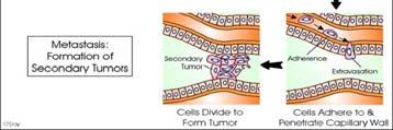 tumors) carcinomas squamous (flat), adeno (glandular) Connective Tissue cartilage, muscle,