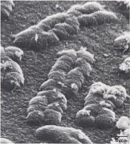 Scanning electron micrograph of several human chromosomes. Source: J.B. Rattner and C.C. Lin, Cell 42 (1985), p. 291.