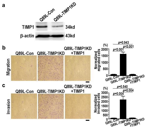 Supplementary Figure 9. hrab37 inhibits lung cancer motility in vitro via TIMP1 (a) Immunoblots for cytosolic expression of TIMP1 and β-actin are shown.