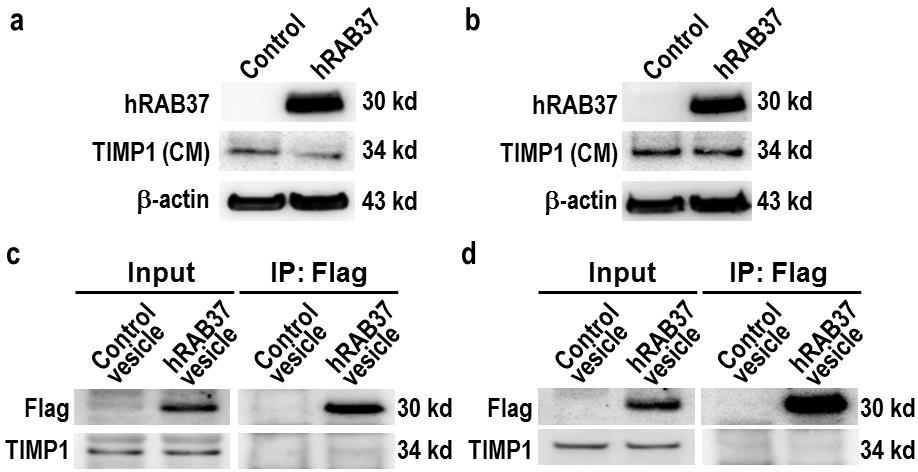 Supplementary Figure 14. TIMP1 is not present in hrab37-containing vesicles of RCC cells.