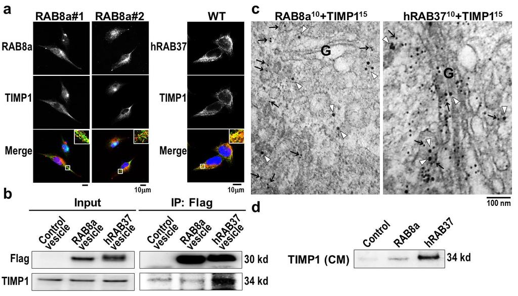 Supplementary Figure 4. Rab8a does not regulate TIMP1 trafficking in CL1-5 cells.