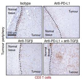 that coinhibition of TGFβ and PD-L1 converted tumours from an excluded to an inflamed phenotype, support a