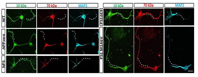 AnkG Downregulation Induces Impaired Selective