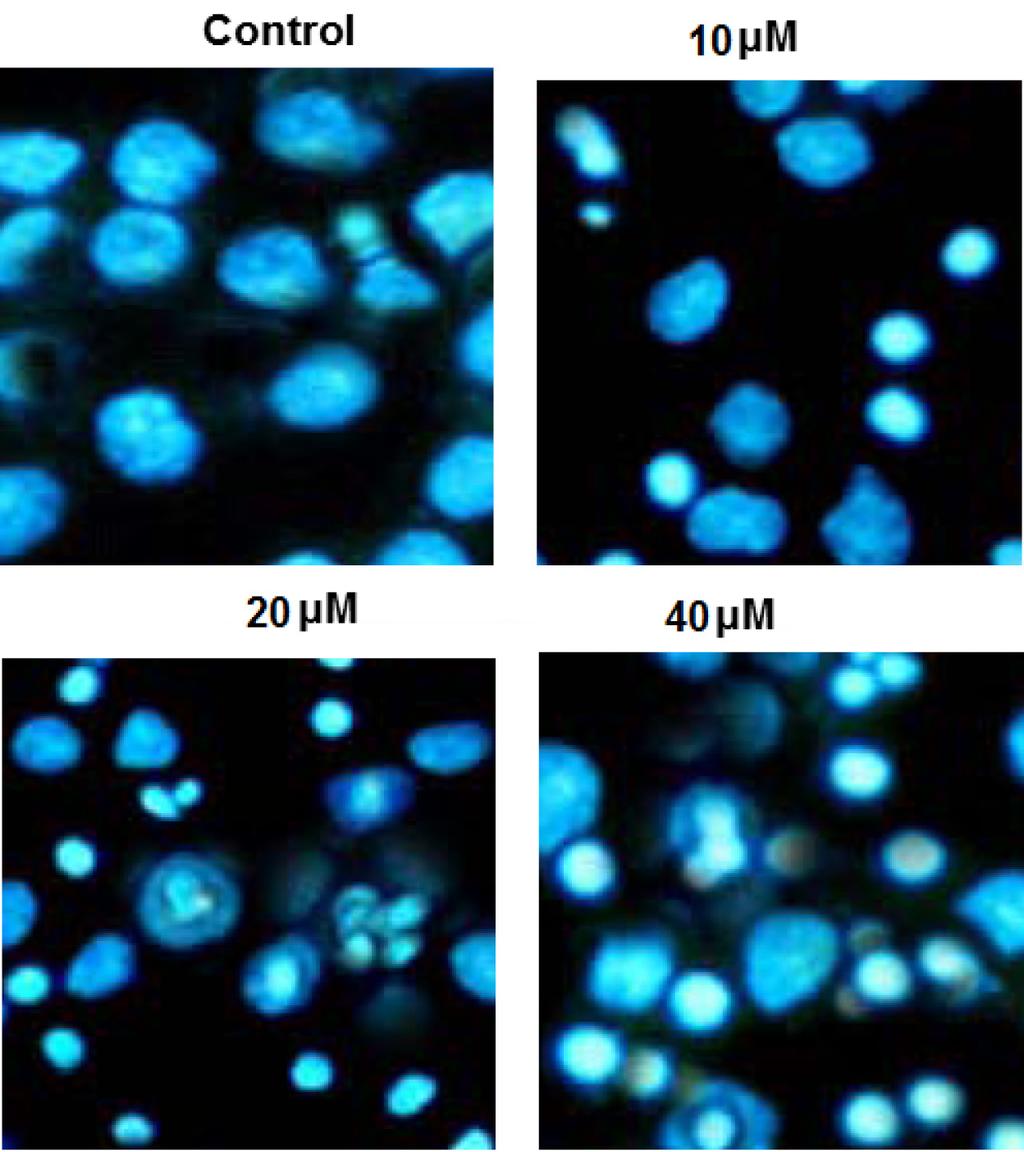 Analysis of apoptotic cell population was further studied by AO/EB staining and showed increased apoptosis with increase in the doses of Sorghumol as indicated by the cells with orange color nuclei