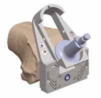 Position the reamer at the lower end of the reaming guide and ream the femoral box by sliding the reamer upwards onto the guide.