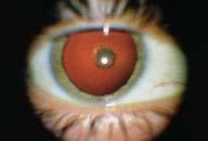 com/science/article/abs/pii/s089152451600063 8 March 1, 2019 Bhat, Pooja and Goldstein, Debra. Pediatric Anterior Uveitis https://www.aao.