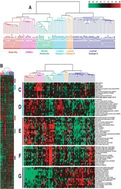Gene Expression Patterns Reveal Novel Breast Sub types Gene expression patterns of 85 experimental samples representing 78 carcinomas, three benign tumors, and four normal tissues, analyzed by