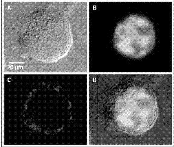 Annex B Comparison of high-resolution optical imaging result (high-resolution ratio of 20 mu m) Figure A is the apoptosis image of human breast cancer cells (MCF-7) treated by Taxol.