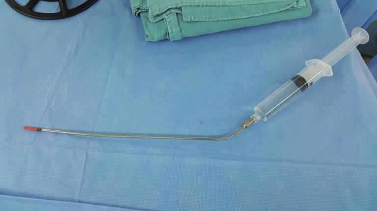 3492 Moon et al. Non-intubated thoracoscopic surgery A B Figure 1 Thoracoscopic-guided intercostal nerve block.