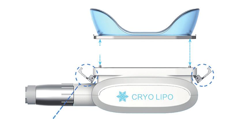 AN UNIQUE PROCESS THE PATENTED CONTOURS CRYOLIPO