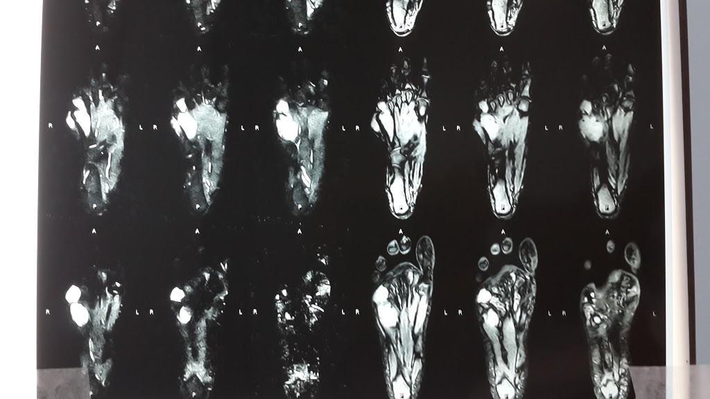 Figure 4: MRI of right foot axial sections Figure 5: MRI of right foot sagittal