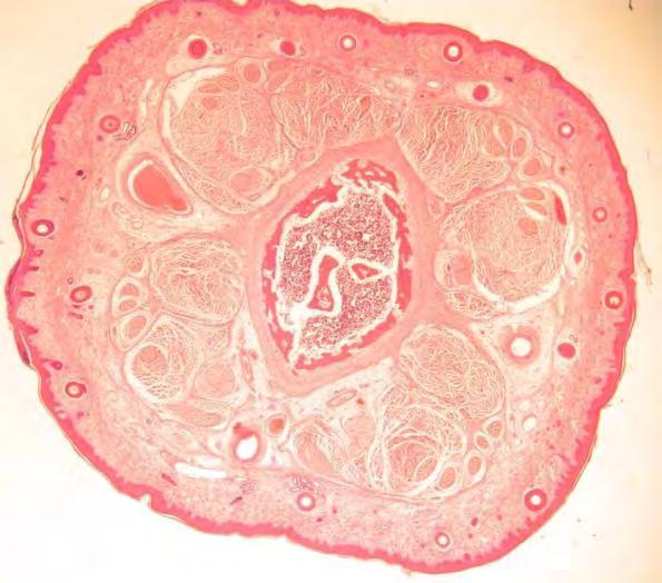 Pig tail - anatomy Pig tail - cross section