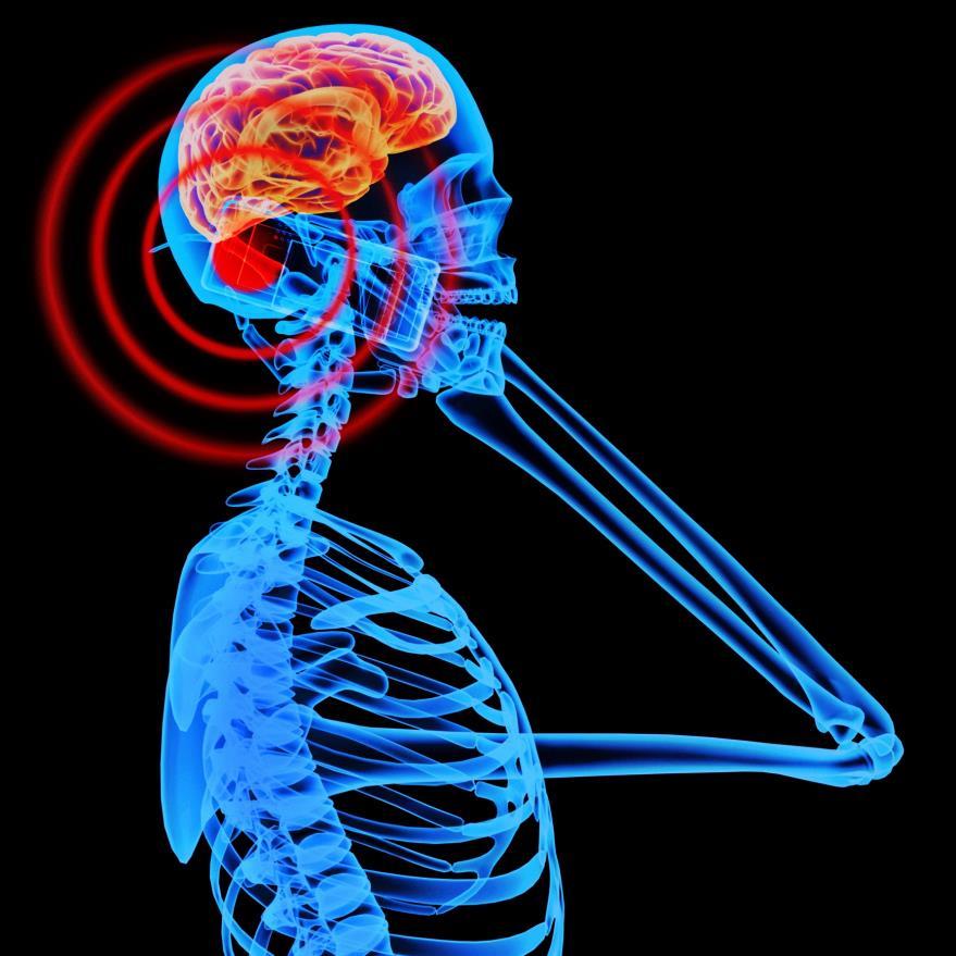 In a human study of 47 healthy people Measure brain metabolism after direct exposure to cell phone Measure when phone was on and off No