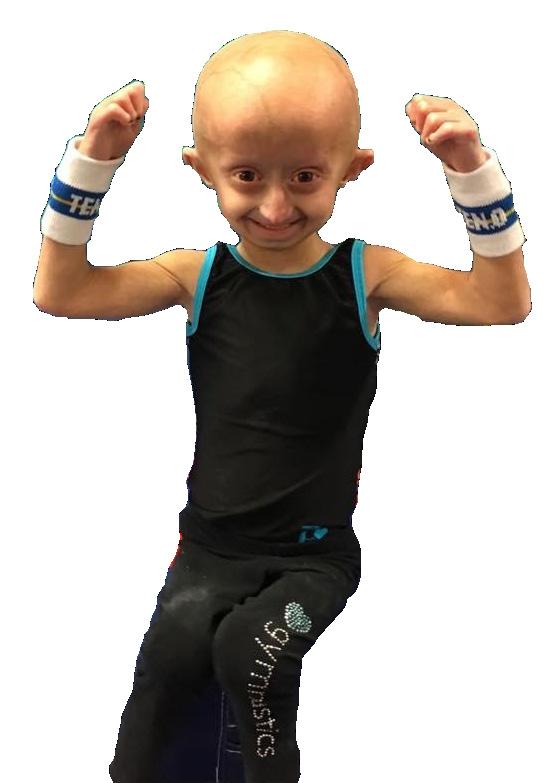 Without the discovery of new treatments, children with Progeria die of the same heart disease affecting millions of normal aging