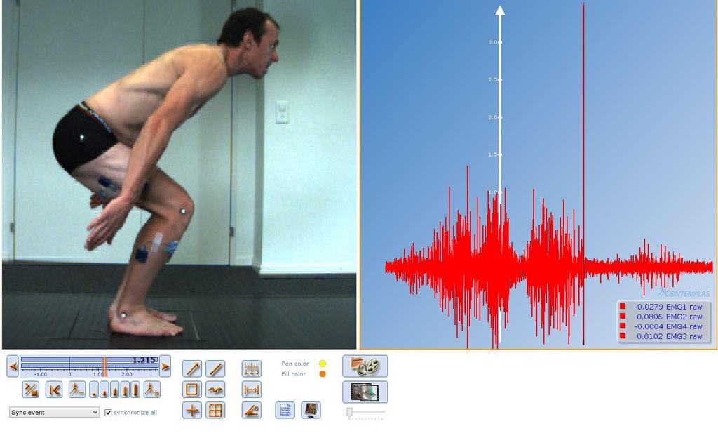 muscle electrical activity resulting