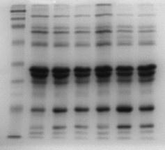 Results: Composition of fractions PROTEIN PROFILE (MW) 207 114 78 53 STD 1 2 3 4 5 6 MUC1 XO