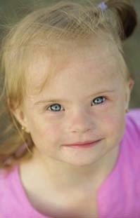 The initial diagnosis is usually made because a doctor notices certain physical characteristics that are more common in people with Down s syndrome.