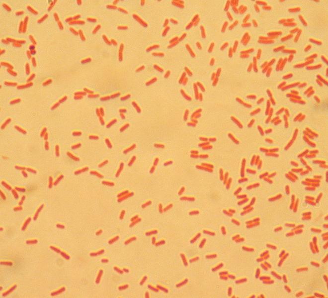 coli But, Escherichia coli from GI tract can infect urinary tract due to poor