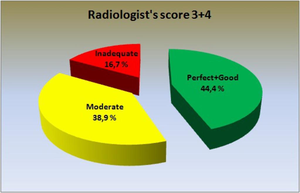 Fig. 2: PGMI results for images in radiologist's classification group 3+4.
