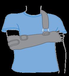After the operation Wearing a sling You will be required to wear a sling for 2 6weeks after a rotator cuff repair.