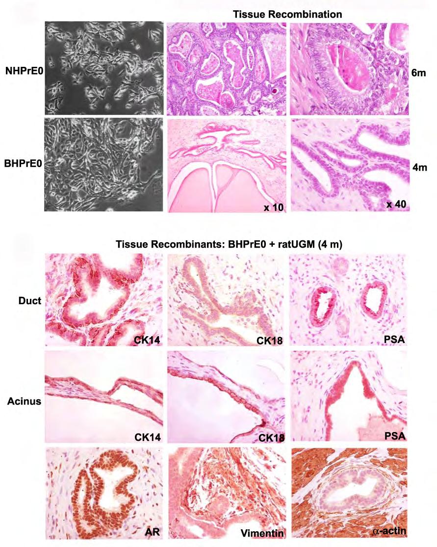and BHPrE) which are able to replicate many critical aspects of human prostate including expression of both androgen receptors and PSA (figure 1). Figure 1.