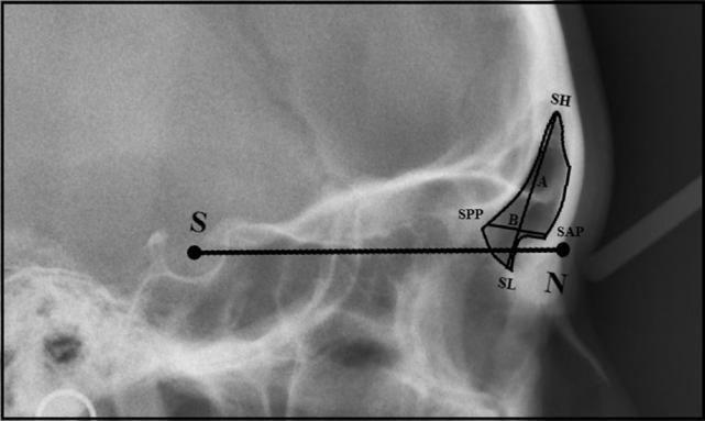 determine the correlation between frontal sinus measurements and cervical stages in the sexes. P value of #0.05 was considered statistically significant.