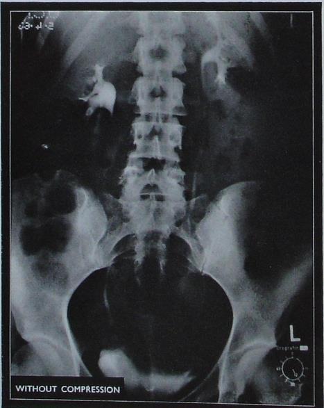 shown :All urinary