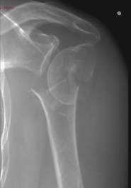 Clinical evaluation History of the fracture Age, sexe,