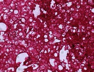 A) Quantification of hepatic lipid content, measured as glycogen staining-total pixel area of 10X photo. Mean + SD.