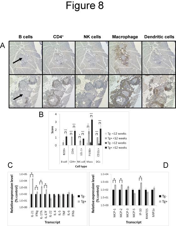 Figure 8: Spontaneous T1D in IL-21Tg mice is associated with a macrophage rich islet infiltrate and the expression of inflammatory cytokines and chemokines in the pancreas.