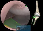 Train your surgery skills using our VirtaMed virtual reality simulators and accelerate the time needed to gain