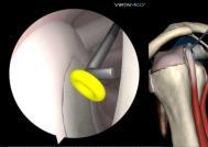 arthroscopic skills exercises, and complete diagnostic and therapeutic arthroscopic interventions.