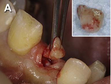 Stem cells in dentistry Part II: