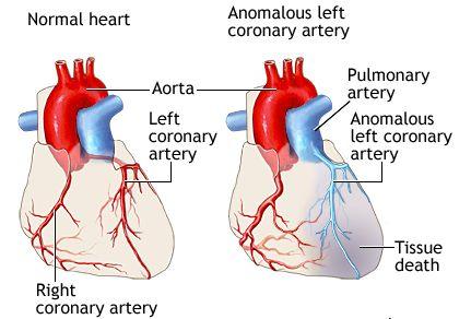 pulmonary artery  
