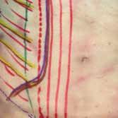 an incision is made in the external oblique fascia lateral to the