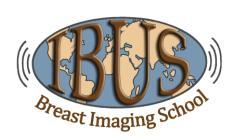 SCIENTIFIC PROGRAM Saturday, 8 th June 2019 08.45-09.00 Opening review D. Koufoudakis 09.00-09.30 Dense breast DBT and ultrasound A. Mundinger 09.30-10.00 Dense breast - ABUS A. Vourtsis 10.