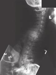 the cervical spine) requiring a repeat examination.