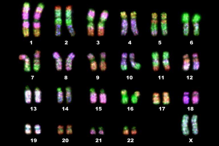 Diagnostic Chromosomal Karyotypes - Looks for
