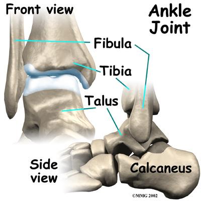 Recent advances in the design of the artificial ankle and changes in the way the operation is performed have made artificial ankle replacement a growing alternative to ankle fusion for the treatment