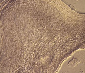 () Sgittl sections of interdentl gingiv were stined for Del-1 nd CD31 (endothelil cell